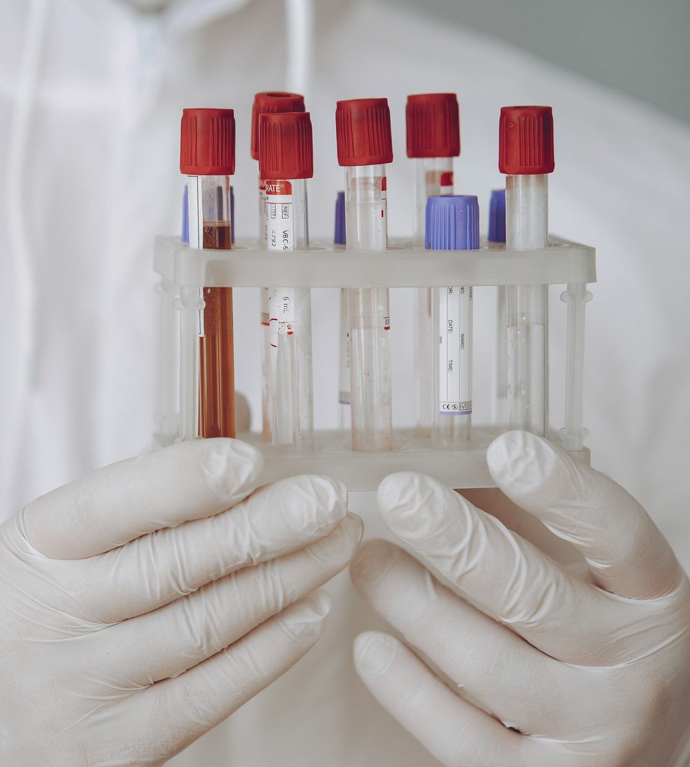 Gloved hands holding a rack of blood sample tubes